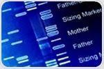 Genetic analysis finds link between obesity-related genes and rheumatoid arthritis