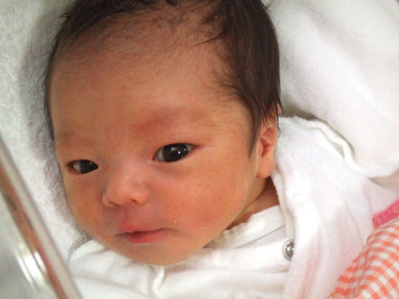 すべてのカタログ 最良かつ最も包括的な 新生児 目 腫れぼったい