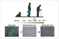 Genetic analysis reveals the inhibitory role of NSD2 enzyme in cellular senescence