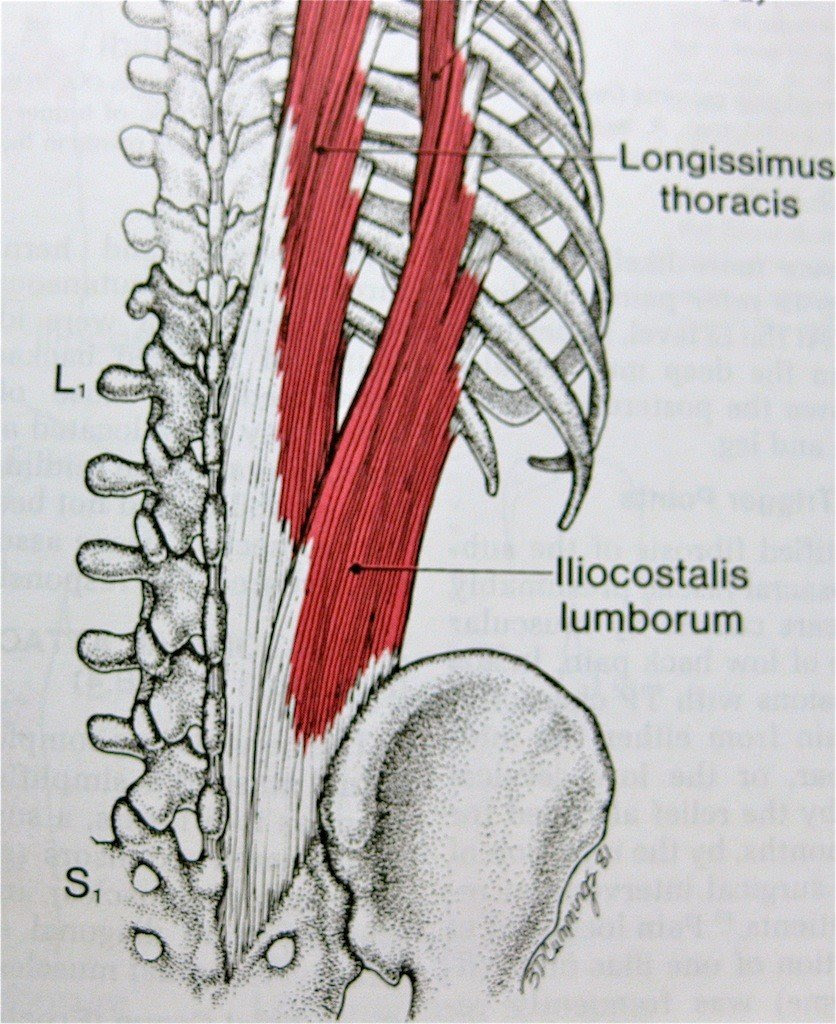 Lower back spasms can be debilitating, but they are treatable. Lower Back Pain The Hip Flexor Fix Therapeutic Personal Trainers North Vancouver