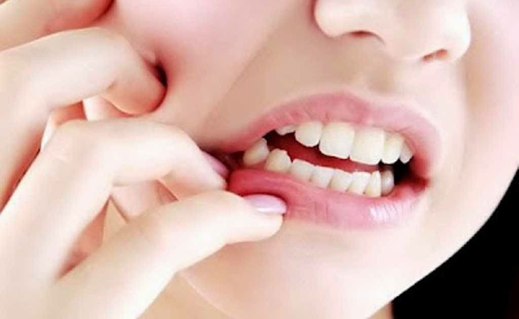 Ubat Tahan Sakit Gigi Untuk Ibu Hamil - Contoh O