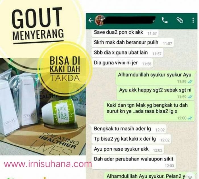 Ubat Kaki Bengkak Air - Nelpon y