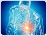 What is Spondyloarthritis?