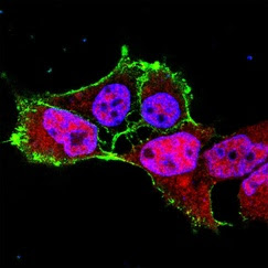 Fluorescent markers label components of cancer pathways