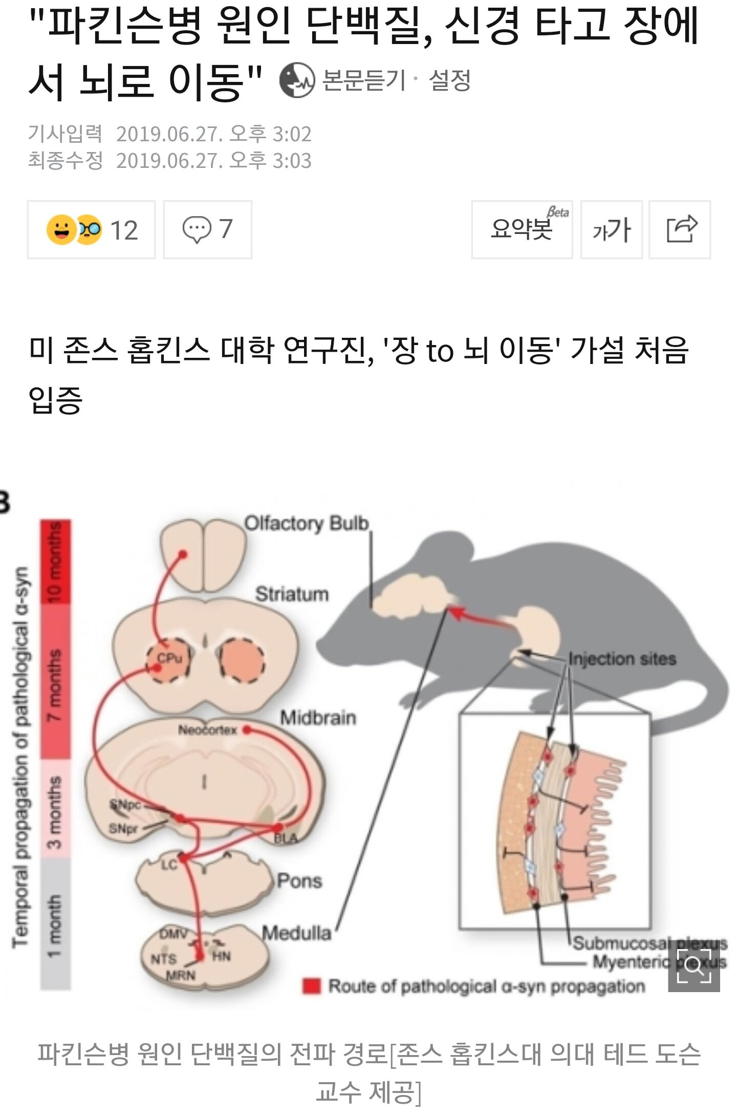 Maybe you would like to learn more about one of these? íŒŒí‚¨ìŠ¨ë³' ì›ì¸ ë‹¨ë°±ì§ˆ ì‹ ê²½ íƒ€ê³  ìž¥ì—ì„œ ë‡Œë¡œ ì´ë™ ì›¹ì§„ ì¸ë²¤ ì¸ë²¤