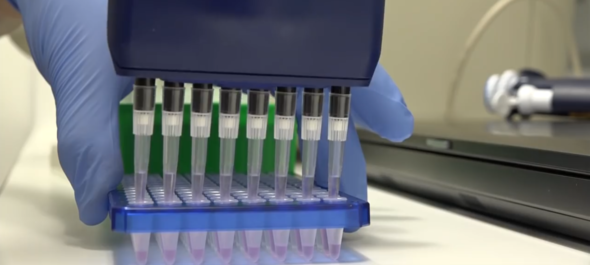 Researcher pipetting samples