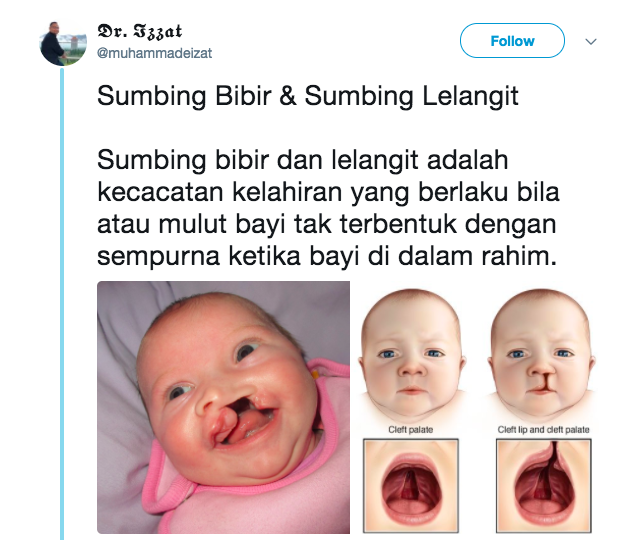 Ubat Telinga Untuk Bayi - Satu Huruf b