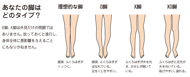 上x きゃく の 治し 方 子供 かわいい子供たちの画像