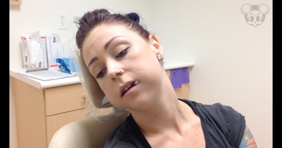 How Long Does Removing All 4 Wisdom Teeth Take - TeethWalls