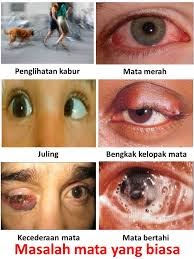 Mata: Jenis-Jenis Masalah Penglihatan