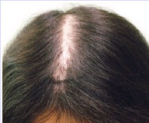 30 代 薄毛 髪型 女性 画像 Khabarplanet Com