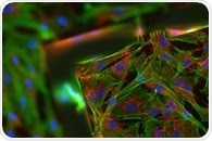 Avoiding Cell Death in Fluorescence Microscopy