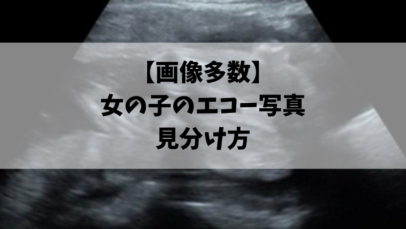 最新 男の子 女の子 エコー 男の子 女の子 エコー