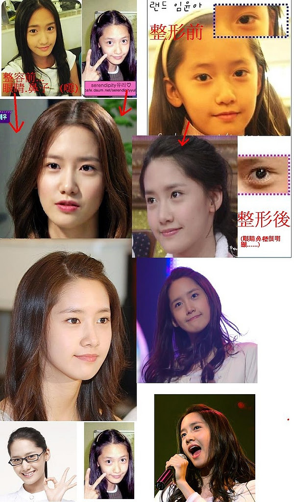 韓国女優整形画像