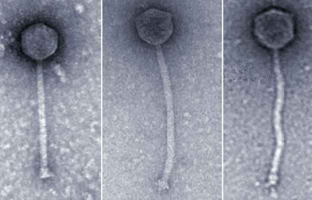 Electron micrographs of three bacteriophages.