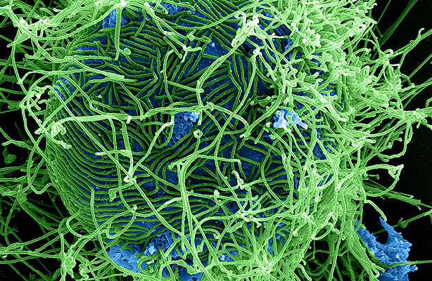 A picture of filamentous Ebola virus particles attached to and budding from an infected cell.