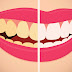 7 Natural Teeth Whitening Home Remedies For A Beautiful Smile