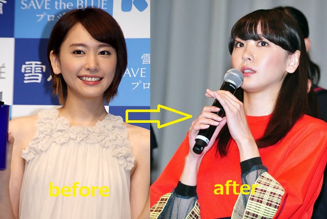 0以上 激 やせ 芸能人 画像 Saikonomuryogazopress