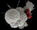 Cancer Immunotherapy