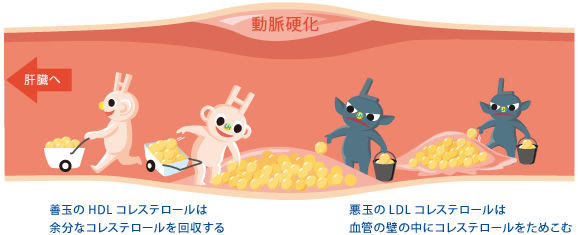 最新動脈 硬化 イラスト ディズニー帝国