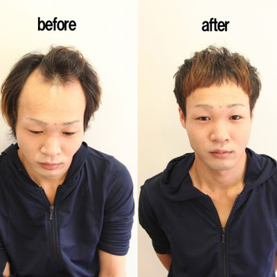 最新 M 字はげ おすすめ 髪型 ヘアスタイルギャラリー