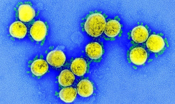 Transmission electron micrograph of SARS-CoV-2 