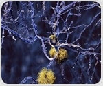 Researchers map molecular structure and dynamics of one of Alzheimer's stickier culprits