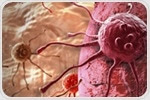 New radiopharmaceutical offers precise diagnosis and treatment of prostate cancer in preclinical studies