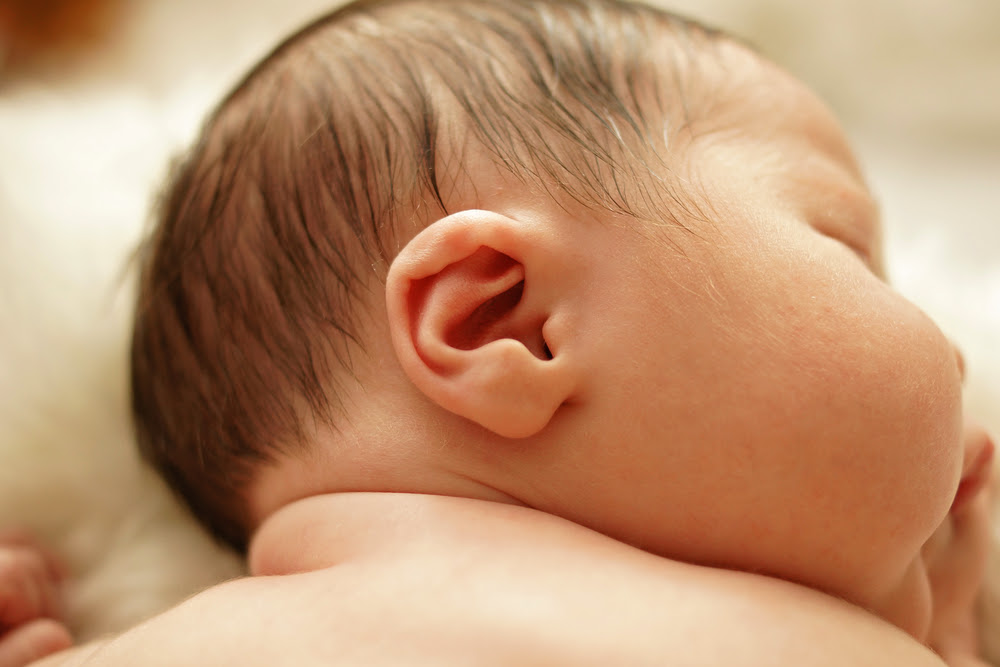 最新 新生児 ダウン症 耳 新生児 ダウン症 耳の形