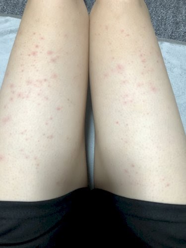 最も好ましい 脇の下 カミソリ 負け