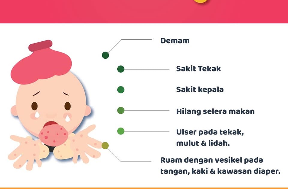 Ubat Sakit Kepala Untuk Ibu Menyusu - Lucu Ora