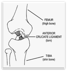 Image Result For Wheelchair Basketball Modifications