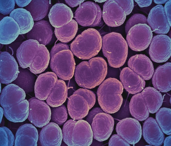 An electron micrograph image of the bacteria which cause gonorrhea