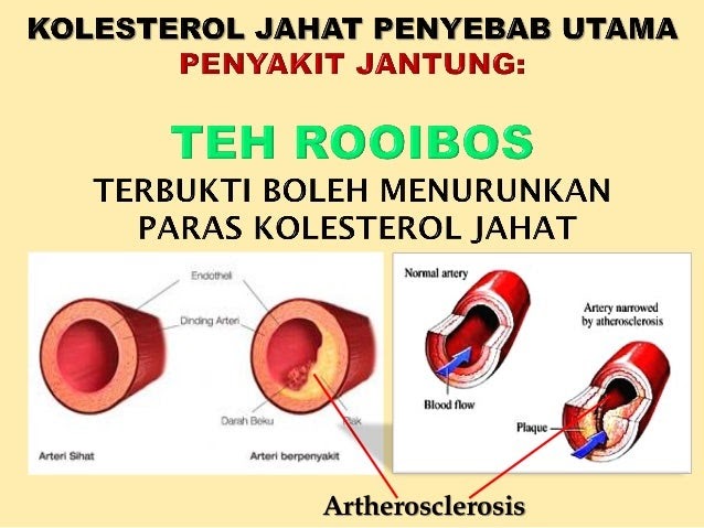 Ubat Migrain Alami - Rawatan p