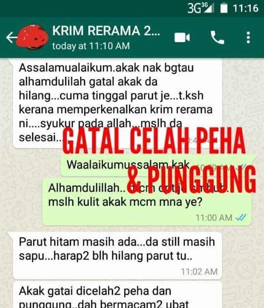 Ubat Hilangkan Gatal Di Punggung - Contoh Ost