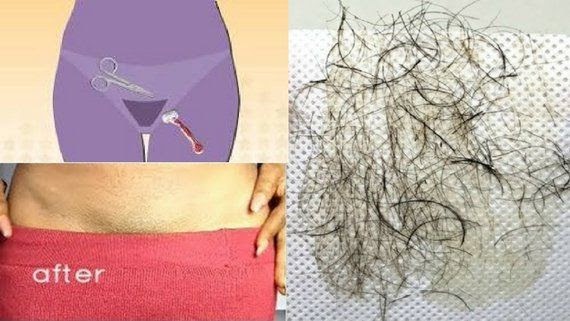 Hair Removal: Pubic hair removal isn't a big issue. If you ...