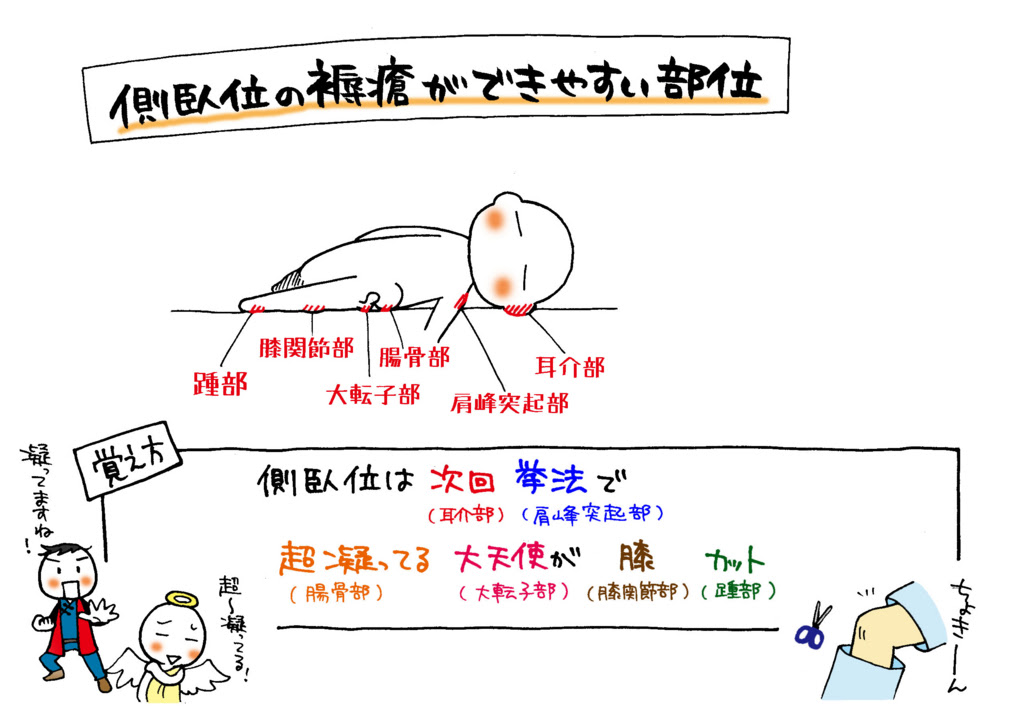 無料イラスト画像 トップ100側臥 位 イラスト