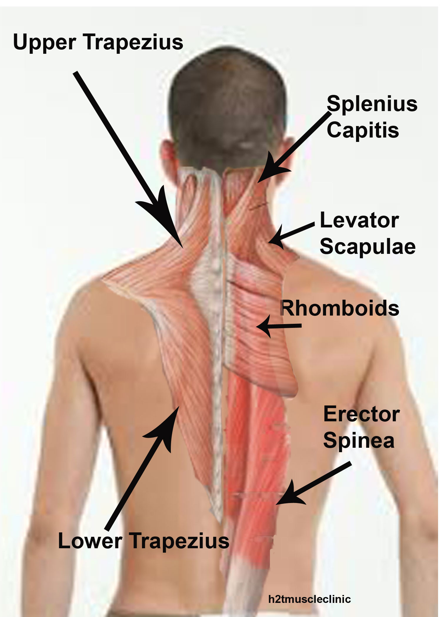 Low back arches, overactive muscles would be the hip flexor complex, the erector spinae, and latissimus dorsi; The 6 Best Muscles To Self Massage For Instant Relief Of Neck And Upper Back Tension Head To Toe Muscle Clinic
