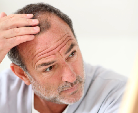 髪型 50 素晴らしい40代 薄毛 髪型 メンズ