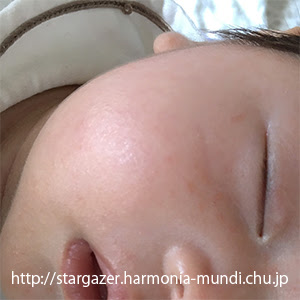 印刷 赤ちゃん へそ 掃除 ワセリン 赤ちゃん へそ 掃除 ワセリン