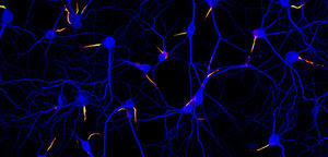 Neurons_2_by_The_Journal_of_Ce.jpg