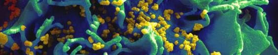 HIV-infected T cell