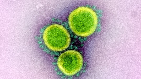 Transmission electron micrograph of SARS-CoV-2 virus particles