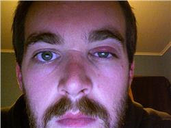Green tea bag for stye is helpful due to its rich healing content. Tea Bags For Stye
