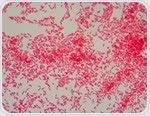 Gram Negative Bacteria