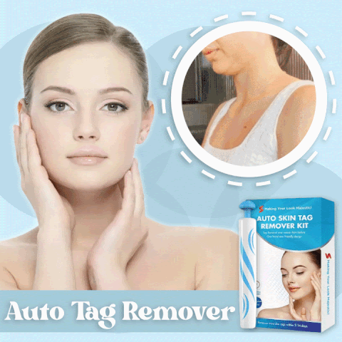 Auto-Micro Skin Tag Remover – Parisian Face