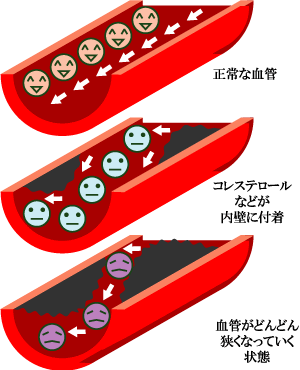 35 血管 イラスト 無料 興味深い画像の多様性