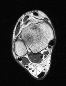 MRI Protocols: ANKLE MRI IMAGING PLANES