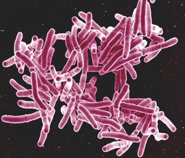 Tuberculosis bacteria (pink)