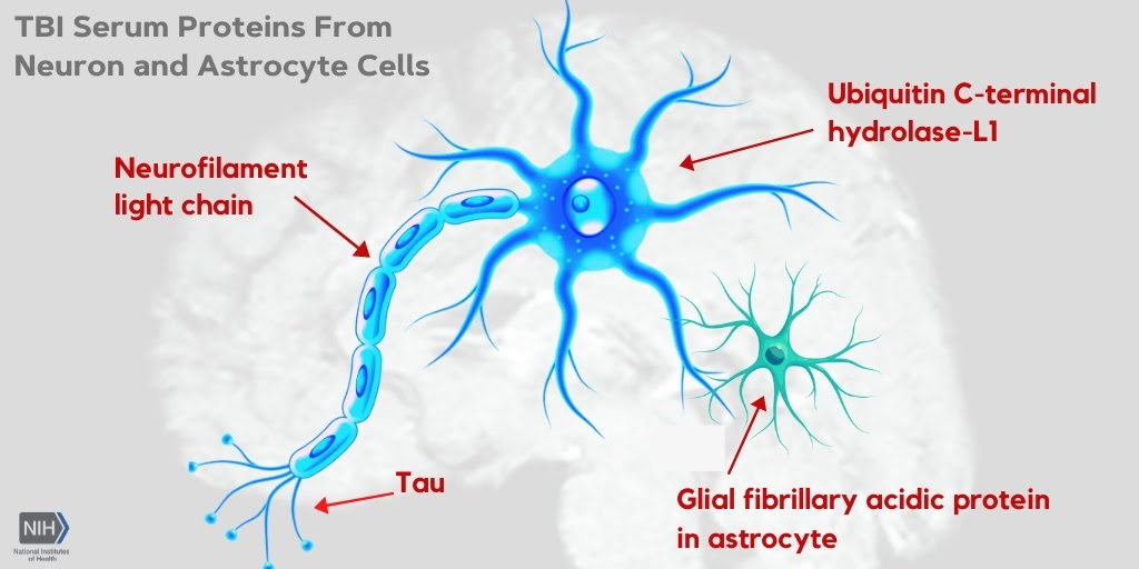 tbi serium